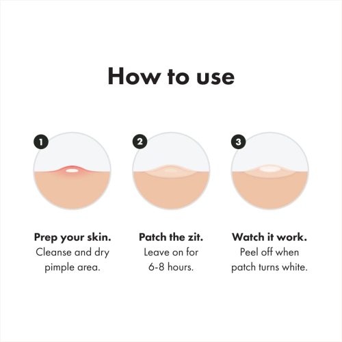 Hero Cosmetics Mighty Patch™ Variety Pack - Hydrocolloid Acne Pimple Patches for Covering Zits and Blemishes - Image 6