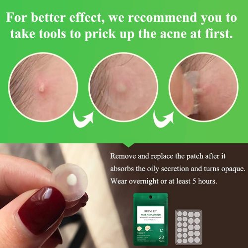 Acne Pimple Patch (66Count), Tea Tree Oil Pimple Patch Acne Pimple Healing Patch Zit Patch Acne Patch Hydrocolloid Patch - Image 5