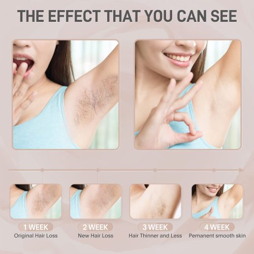 Laser Hair Removal for Women and Men IPL Hair Remover Facial Whole Body Machine Permanent Painless Device at Home 999,999 Flashes - Image 6