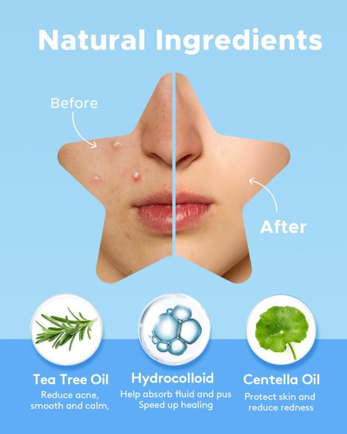 LitBear Acne Patch with Tea Tree & Centella Oil, 168 Hydrocolloid Dots in 6 Colors for Face - Cute Star Pimple Stickers - Image 10