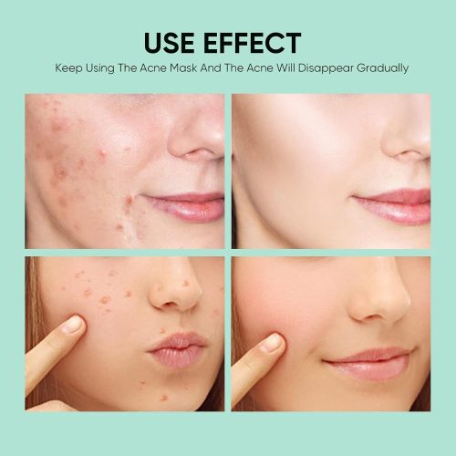 Collagen Face Mask Skin Care Hydrating Face Masks, Brightening and Anti Aging Face Sheet Masks - Image 5