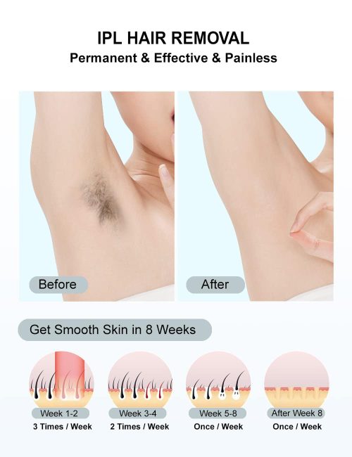 IPL Hair Removal,Laser Hair Removal At-Home for Women Men - Image 2