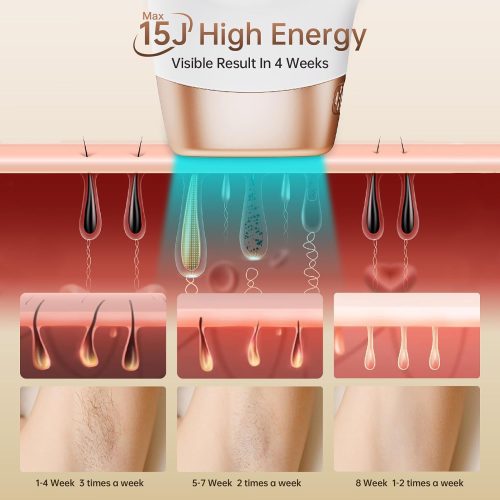 Laser Hair Removal Device for Women and Men, 999,900+ Flashes at-Home IPL Hair Removal Device - Image 2