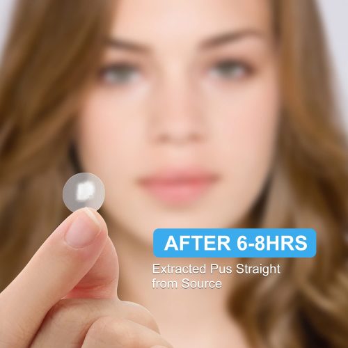 Day and Night Hydrocolloid Acne Pimple Patch for Covering Zits and Blemishes - Image 3
