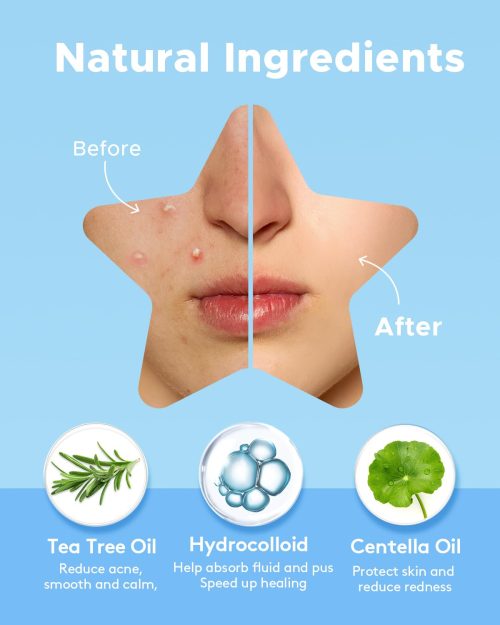 LitBear Acne Patch with Tea Tree & Centella Oil, 168 Hydrocolloid Dots in 6 Colors for Face - Cute Star Pimple Stickers - Image 3