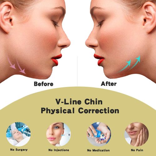 Silicone Chin Strap，V Line Face Mask Face Strap，Chin Mask（2 pack） - Image 2