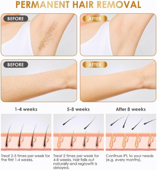 IPL Laser Hair Removal Device Permanent Painless Remover Reduction in Hair Regrowth - Image 13