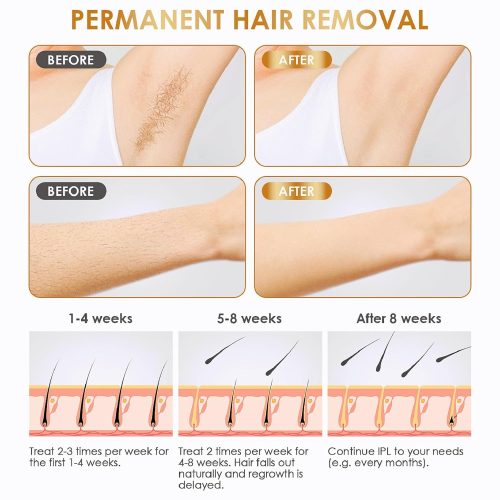 Laser Hair Removal,IPL At-Home Hair Removal Device for Women and Men - Image 5