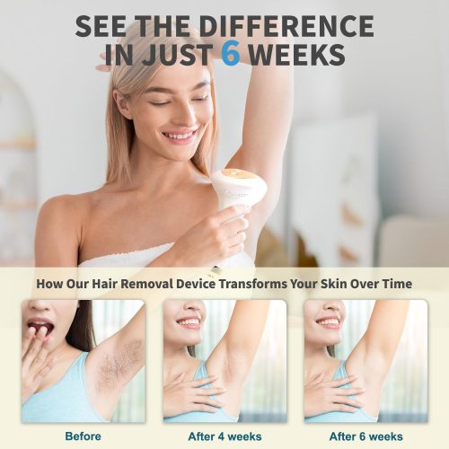 IPL Hair Removal Device for Men and Women - Image 4