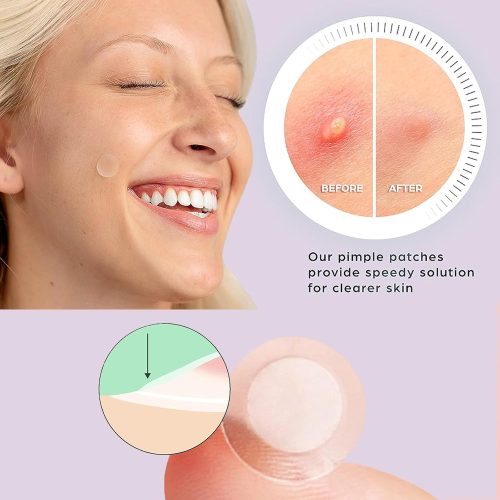Hydrocolloid Acne Pimple Patch,Salicylic Acid Acne Patches for Covering Zits and Blemishes（2 boxes） - Image 4