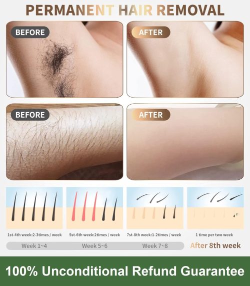 IPL Laser Hair Removal Device Permanent Painless Remover Reduction in Hair Regrowth - Image 8
