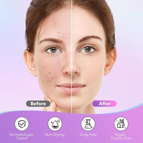 Pimple Patches for Face, Hydrocolloid Acne Patches - Image 7