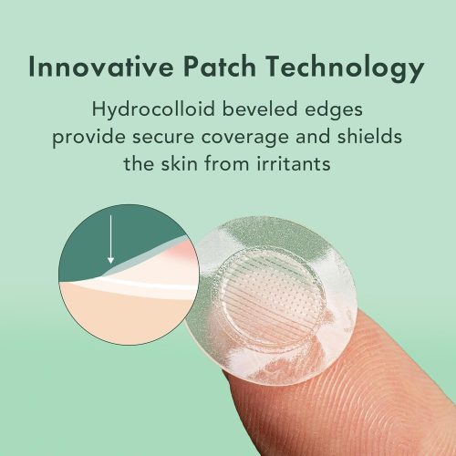 Pimple Patches, Miracle Microcrystal Spot Cover - Hydrocolloid Acne Patches for Early Stage - Image 6