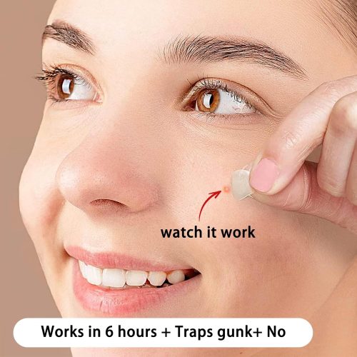 Hydrocolloid Acne Pimple Patch Kit, 72pcs Invisible Pimple Patches - Image 3