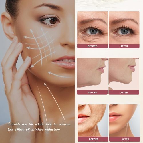 Radio Frequency Skin Care Device for Skin Wrinkles with Light Based, Radio Frequency for Wrinkle Remover - Image 2
