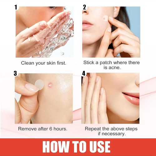 Hydrocolloid Acne Pimple Patch,Salicylic Acid Acne Patches for Covering Zits and Blemishes（2 boxes） - Image 7