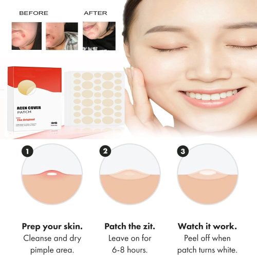 Hydrocolloid Acne Pimple Patch,Salicylic Acid Acne Patches for Covering Zits and Blemishes（2 boxes） - Image 2