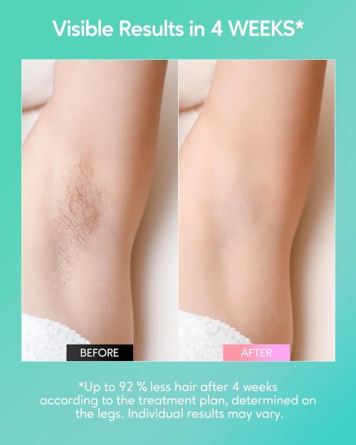 IPL Hair Removal Device for Women and Men at Home,Permanent Hair Remover Machine - Image 5