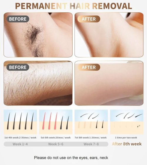 IPL Laser Hair Removal Device Permanent Painless Remover Reduction in Hair Regrowth - Image 19