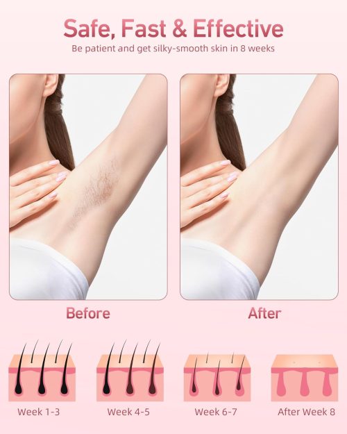 Laser Hair Removal for Women and Men Permanent IPL Hair Removal at-Home 999,999 Flashes Painless Hair Remover on Armpits Back Legs Arms Face Bikini Line - Image 4