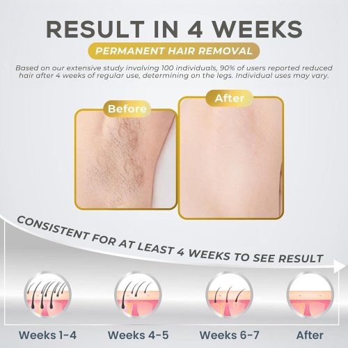 Hair Removal Device for Women and MenWhole Body Pulsed Light Technology, Unlimited Flashes. - Image 4