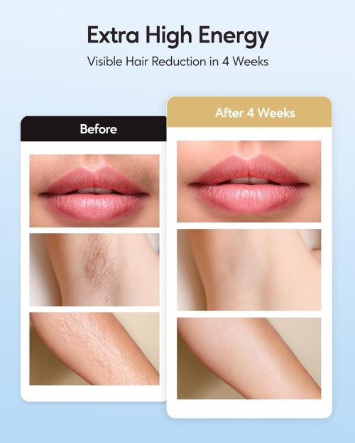 Laser Hair Removal with Ice Cooling Care Function for Women Permanent,999,999 Flashes Painless IPL Hair Remover - Image 3