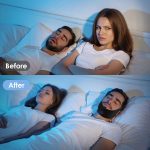 Anti Snoring Chin Strap for CPAP Users - Image 4
