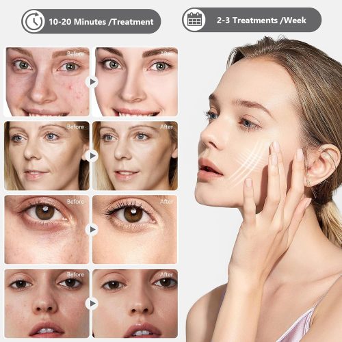 7 Colors Face Mask with Spray, Yofuly Professional Led Light Face Tool - Image 4