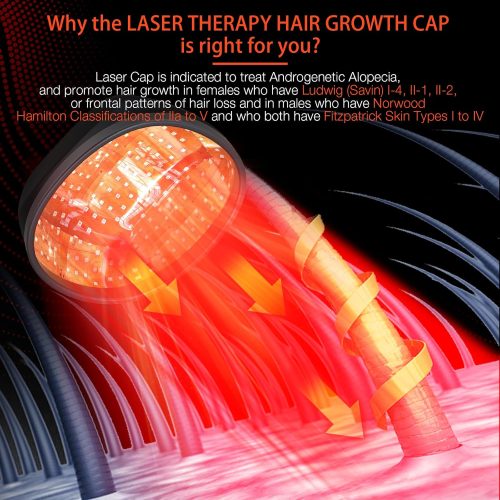 Professional Medical Grade Lasers Hair Growth Treatment Product for Men & Women, Red Light Therapy for Hair Growth - Image 6