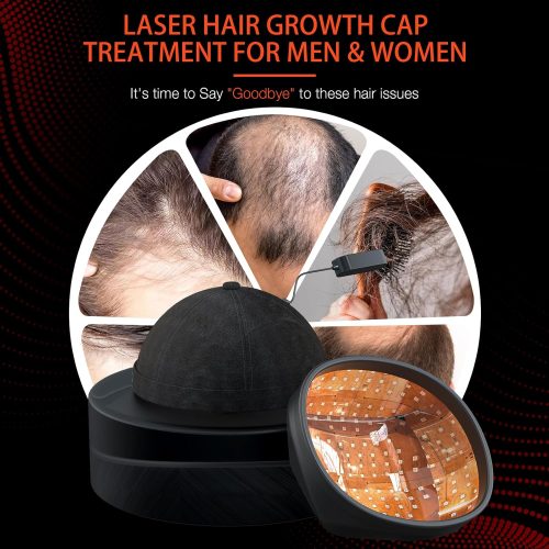 Professional Medical Grade Lasers Hair Growth Treatment Product for Men & Women, Red Light Therapy for Hair Growth - Image 7