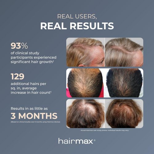 FDA Cleared Laser Hair Growth Cap Device - Image 3